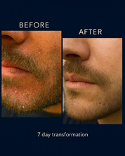 Beard Repair Serum